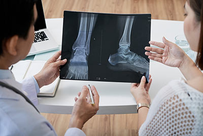 Patient and Doctor looking at x-ray of foot.