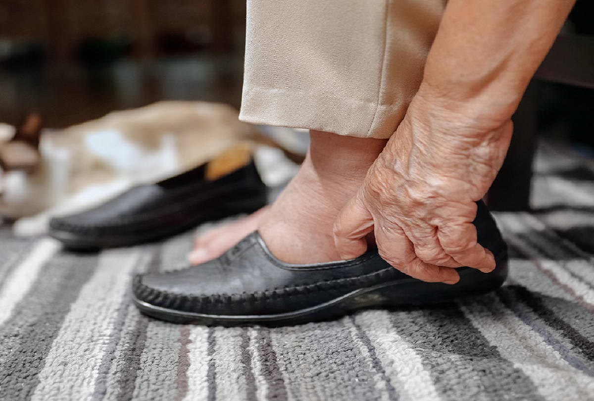 Swollen foot of woman in shoe